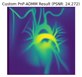 ../_images/tutorials_csmri_11_0.png