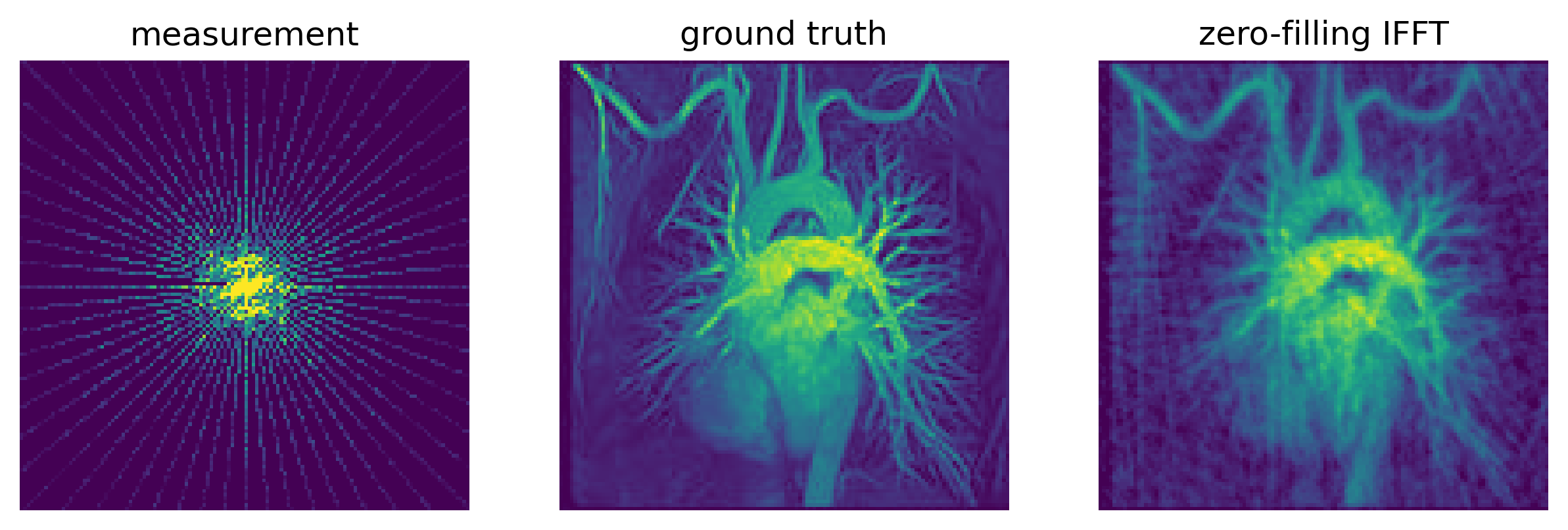 ../_images/tutorials_csmri_4_0.png