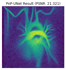 ../_images/tutorials_csmri_6_0.png
